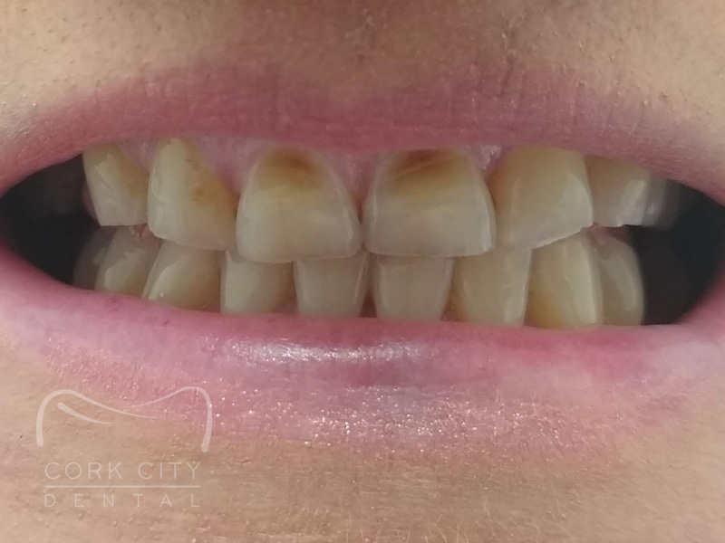 Dental Treatment - Before