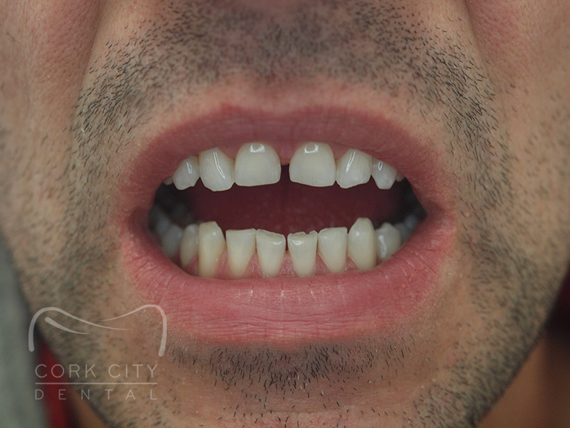 Dental Treatment - Before