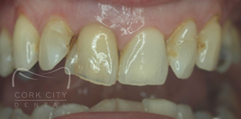 Cosmetic Dentistry - before